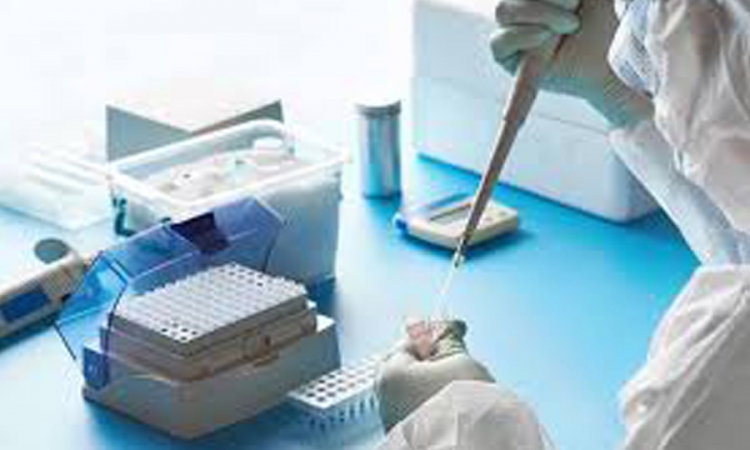 ඊයේ (28)  PCR පරීක්ෂණ 10,421 ක්