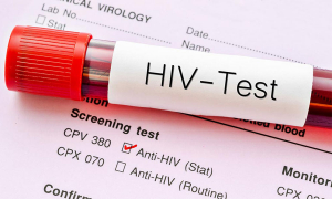 HIV පරීක්ෂණ සඳහා අන්තර්ජාලය මඟින් වෙලාවක්